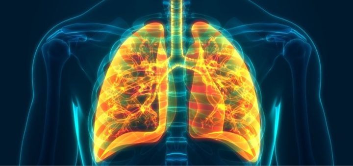 Image of the x-ray of the lungs